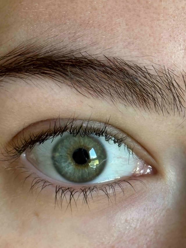 Before Iris Enhancement